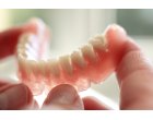 Inlocuirea Dintilor Pierduti: O Abordare Cuprinzatoare in Protetica Dentara