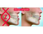 Dr. Slavescu aduce armonia pe chip printr-o interventie complexa la Clinica Zetta! Chirurgie ortognata de top!