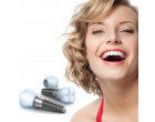 Te confrunti cu dinti lipsa? Iata ce solutii ai in materie de implanturi dentare
