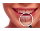 Iata ce trebuie sa stii despre riscurile unui implant dentar!