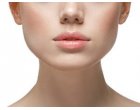 Mărirea buzelor cu acid hialuronic este una dintre cele mai popupare intervenţii estetice