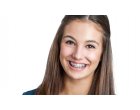 Pentru montarea unui aparat dentar, adreseaza-te unui specialist in ortodontie!