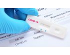 De ce sa faci un test de coronavirus?