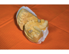 Tot ce trebuie să ştie pacienţii despre recuperarea după implantul dentar – ce trebuie să facă şi ce să evite pentru succesul procedurii?
