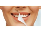 3 metode profesionale de albire a dinților