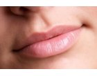 Mituri legate de marirea buzelor cu acid hialuronic