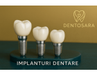 Ce se întâmplă după pierderea unui dinte? De la amânare la alegerea unui implant dentar